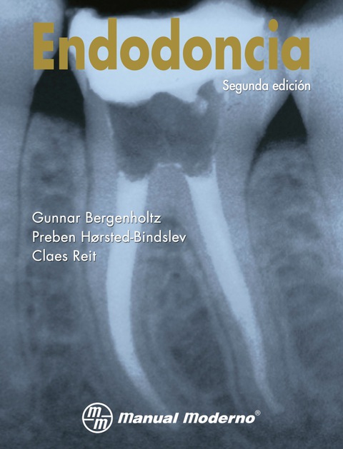 Endodoncia