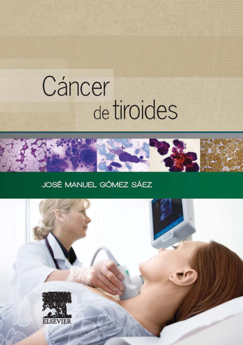 Cáncer de tiroides