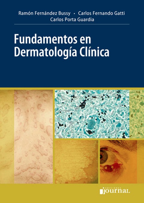 Fundamentos en Dermatología clínica
