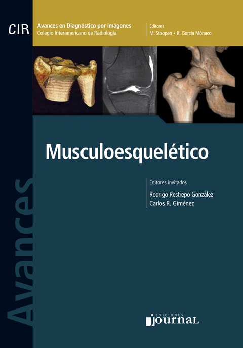 Avances en diagnóstico por imágenes: Musculoesquelético