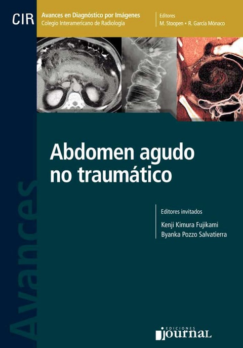 Avances en diagnóstico por imágenes: Abdomen agudo no traumático