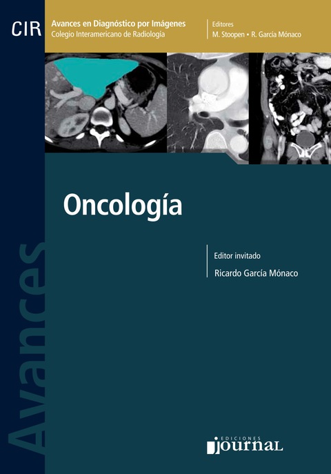 Avances en diagnóstico por imágenes: Oncología