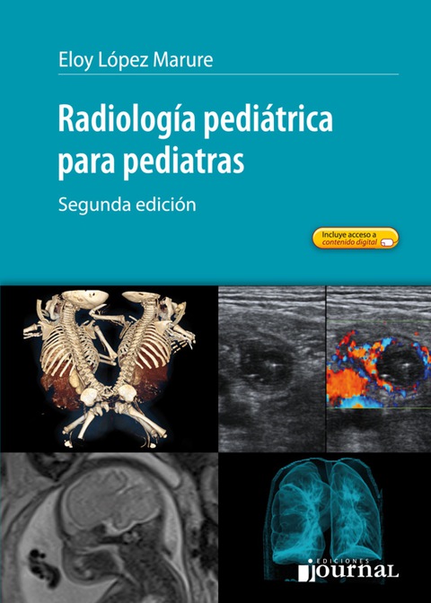 Radiología pediátrica para pediatras