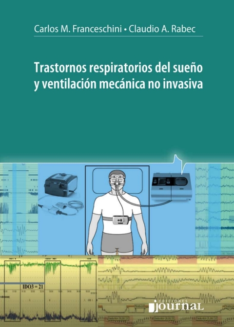 Trastornos respiratorios del sueño y ventilación mecánica no invasiva