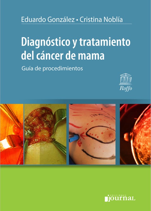 Diagnóstico y tratamiento del cáncer de mama