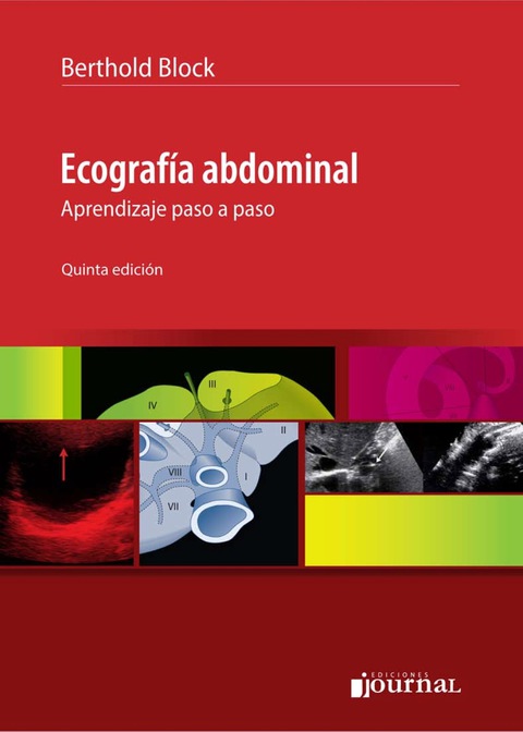 Ecografía abdominal: Aprendizaje paso a paso