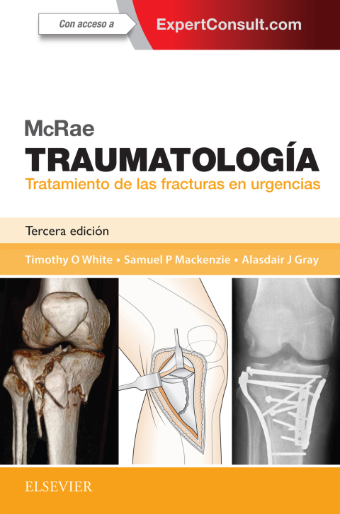 McRae. Traumatología. Tratamiento de las fracturas en urgencias McRae. Traumatología. Tratamiento de las fracturas en urgencias