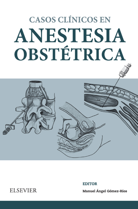 Casos Clínicos en anestesia obstétrica