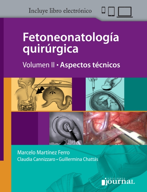 Fetoneonatología Vol 2
