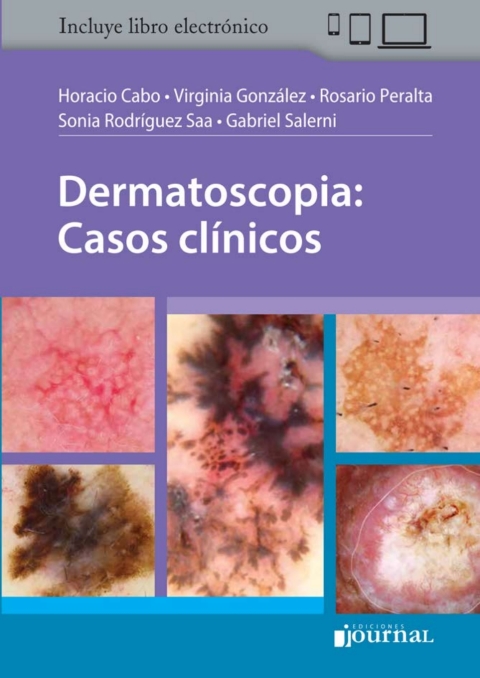 Dermatoscopia – Casos clínicos