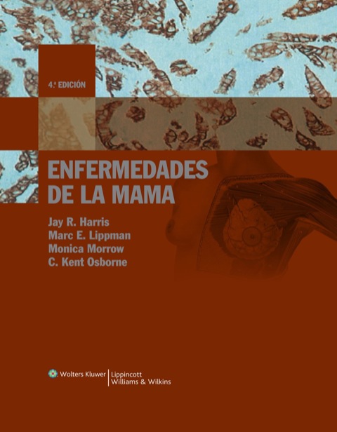 Enfermedades de la mama Enfermedades de la mama