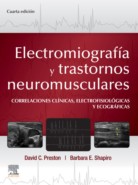 Electromiografía y trastornos neuromusculares